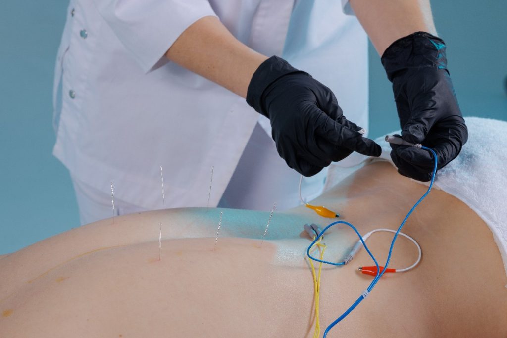 A Physician Connects An Electromyostimulator To Needles On A Man